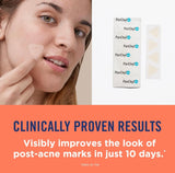 PanOxyl Blemish Brightening Patches