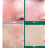 SOME BY MI  AHA, BHA, PHA 30 Days Miracle Serum - 50ml - Glamorous Beauty
