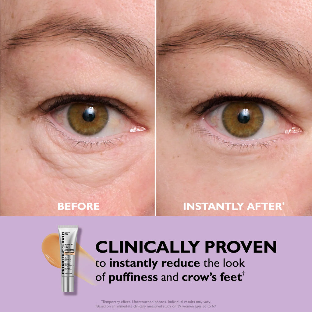 Peter Thomas Roth Temporary Eye Tightener Easy-Wear Formula