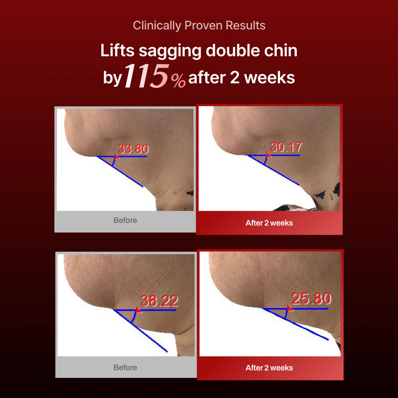 Meditherapy Wrinkle-Fit Neck Mask Set 7ae