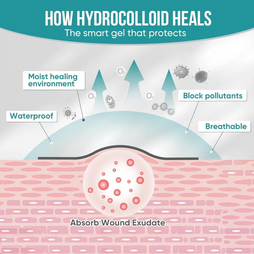 Hydrocolloid Roll for Wound Care - Glamorous Beauty