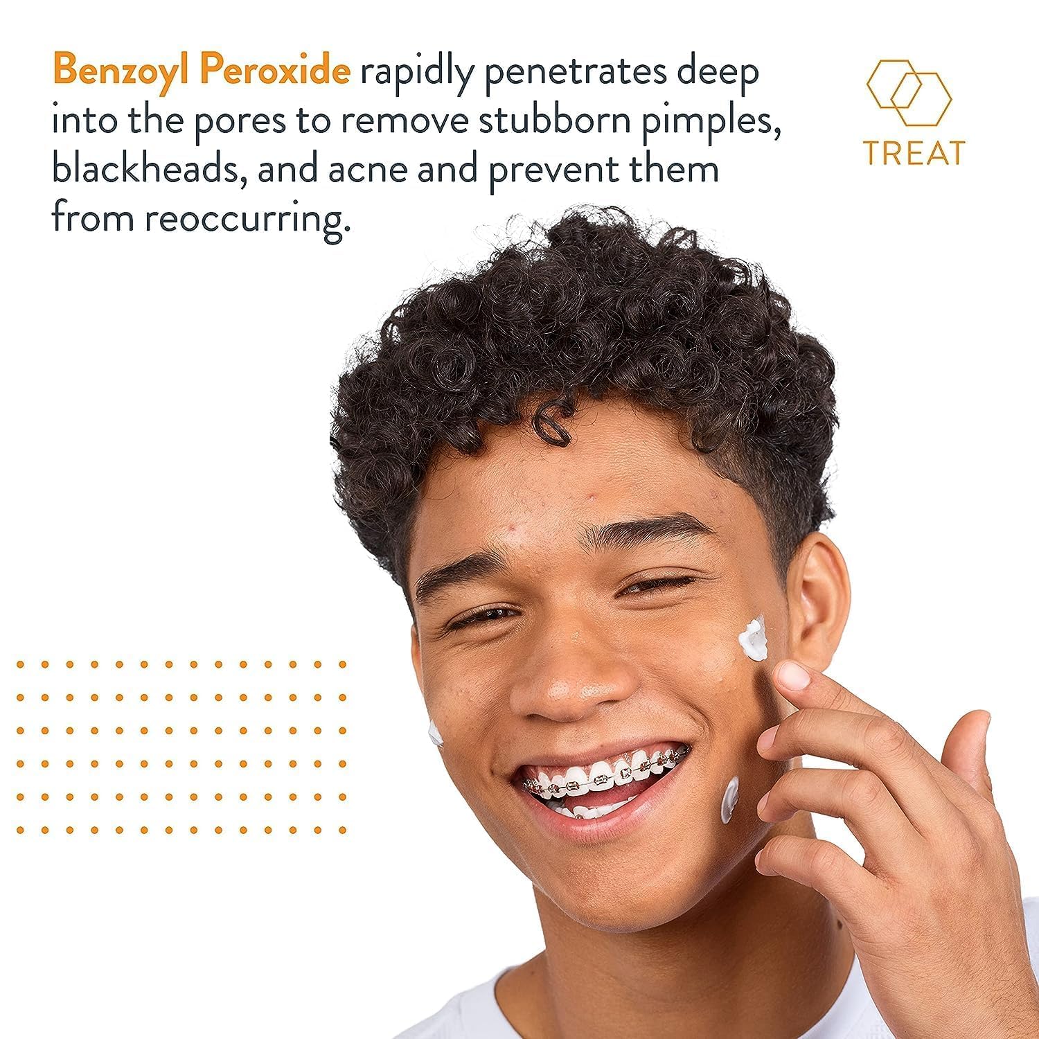 AcneFree Terminator 10 Acne Spot Treatment with Benzoyl Peroxide