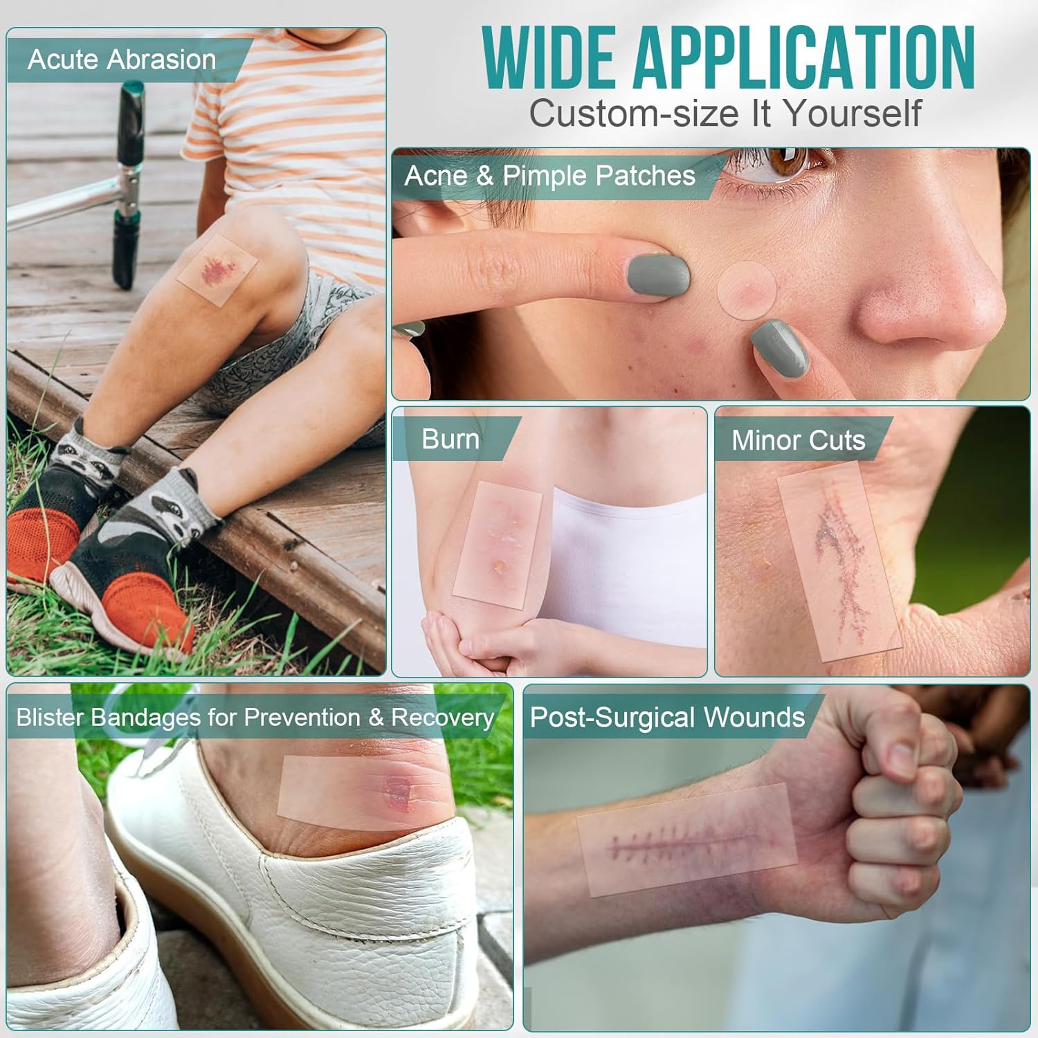 Hydrocolloid Roll for Wound Care - Glamorous Beauty