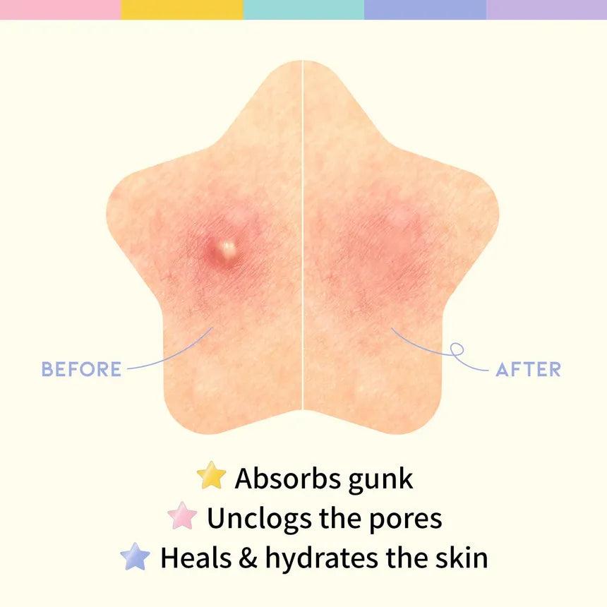 OOTD Star Spot Patch - Glamorous Beauty