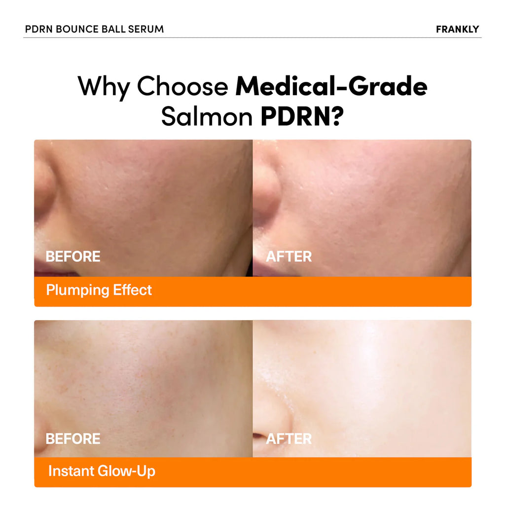 FRANKLY PDRN Bounce Ball Serum