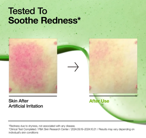 Anua Azelaic Acid 10 Hyaluron Redness Soothing Serum - Glamorous Beauty