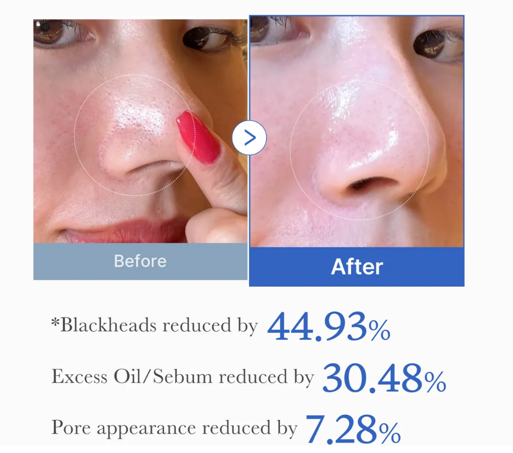 Medicube Zero Pore Pad