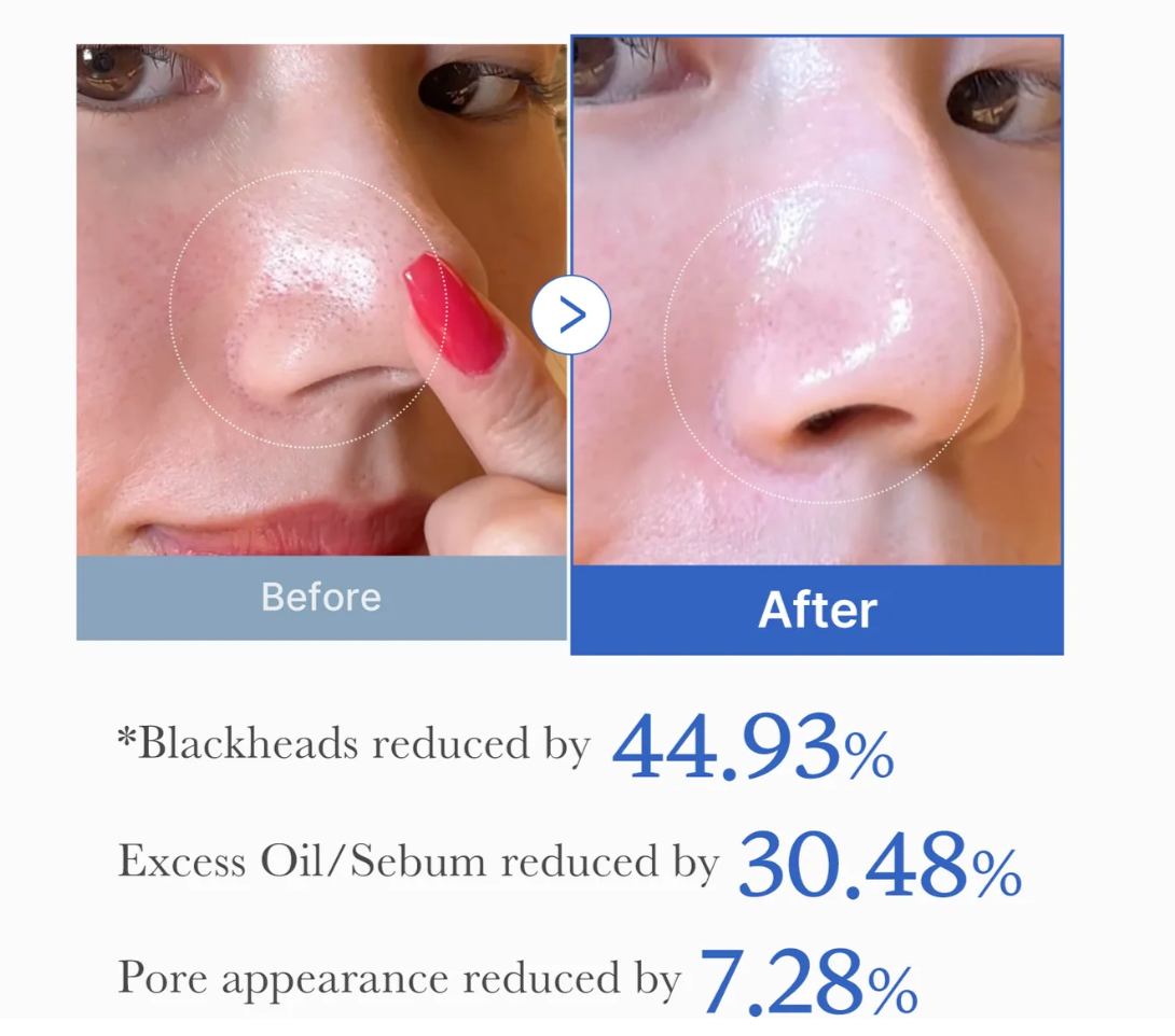 Medicube Zero Pore Pad
