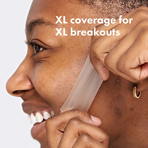 hero Mighty Patch Surface