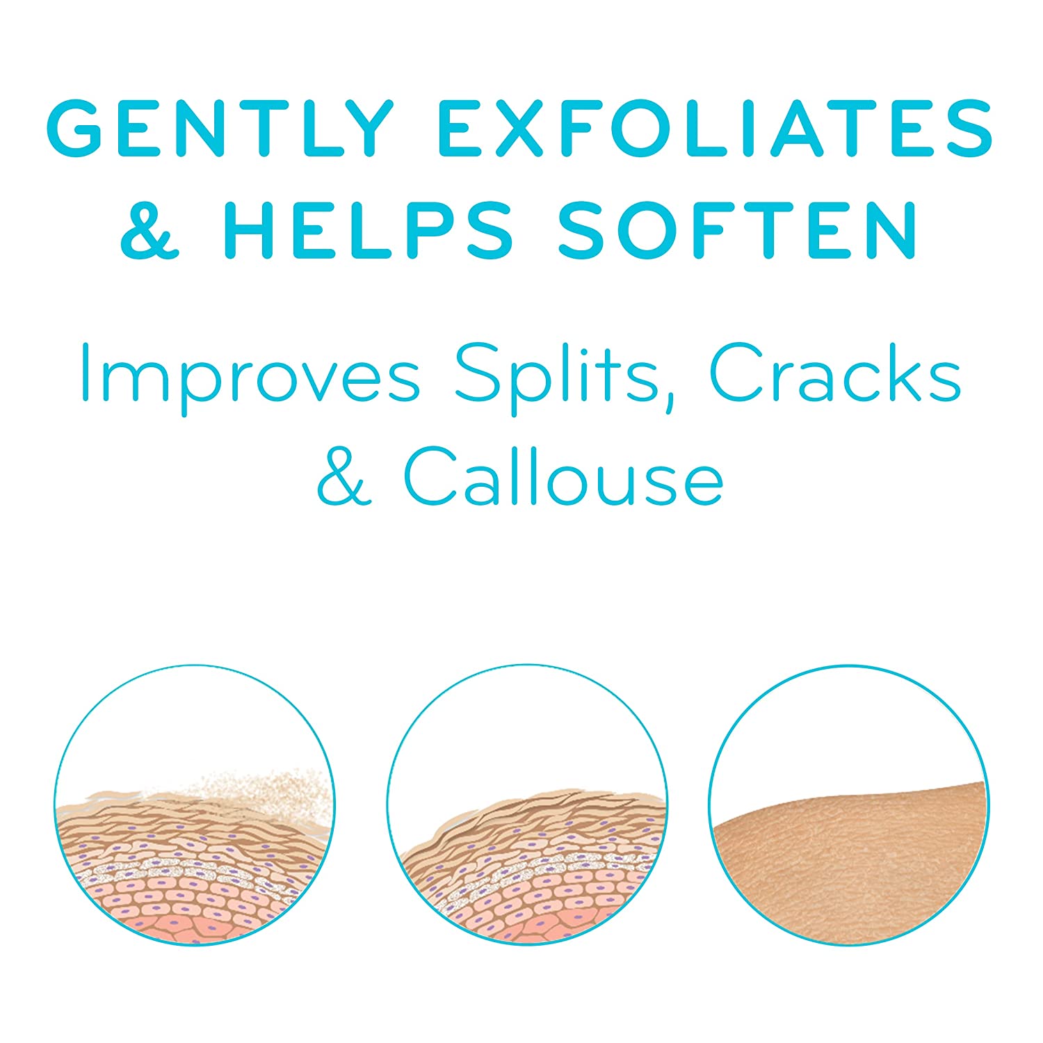 AmLactin Foot Repair Cream Therapy With 15% lactic acid