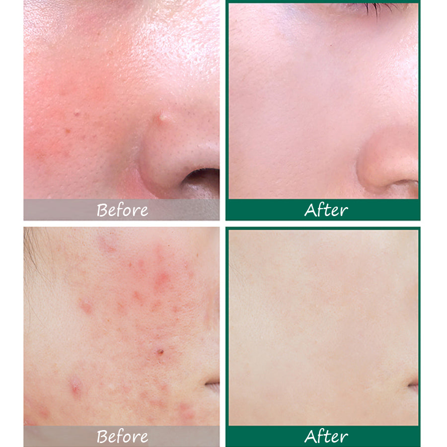 SOME BY MI  AHA, BHA, PHA 30 Days Miracle Serum - 50ml - Glamorous Beauty