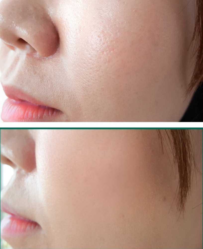 Some By Mi AHA.BHA.PHA 30 Days Miracle Foam - 100ml - Glamorous Beauty