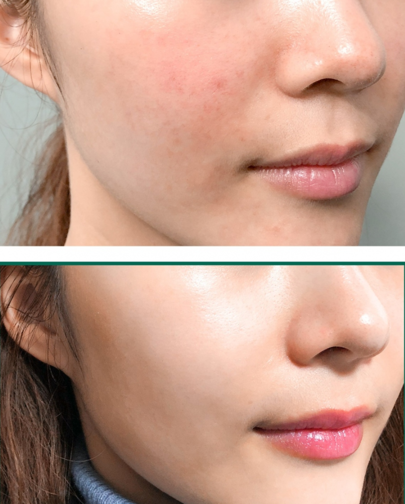Some By Mi AHA.BHA.PHA 30 Days Miracle Foam - 100ml - Glamorous Beauty