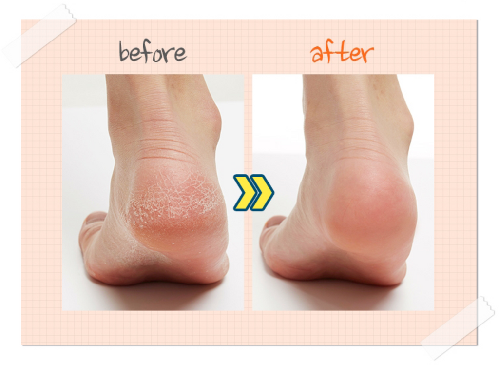 A'PIEU Soft Foot Peeling Socks