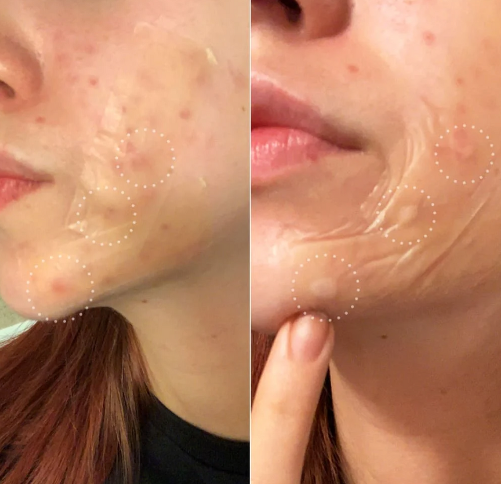 hero Mighty Patch Surface