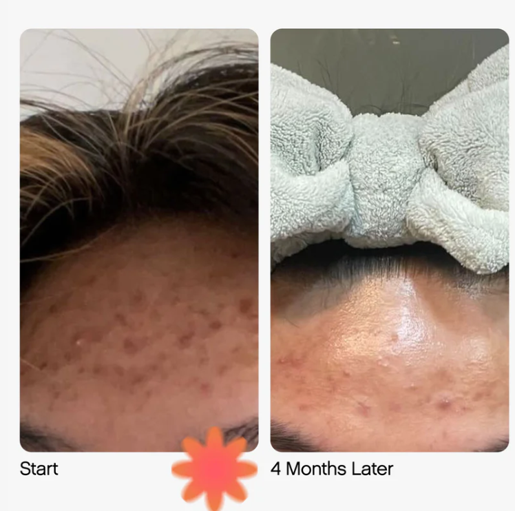 Topicals Faded Serum for Dark Spots & Discoloration - Glamorous Beauty