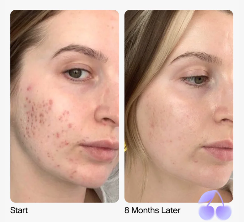 Topicals Faded Serum for Dark Spots & Discoloration - Glamorous Beauty