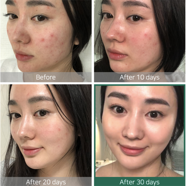 SOME BY MI  AHA, BHA, PHA 30 Days Miracle Toner - 150ml - Glamorous Beauty