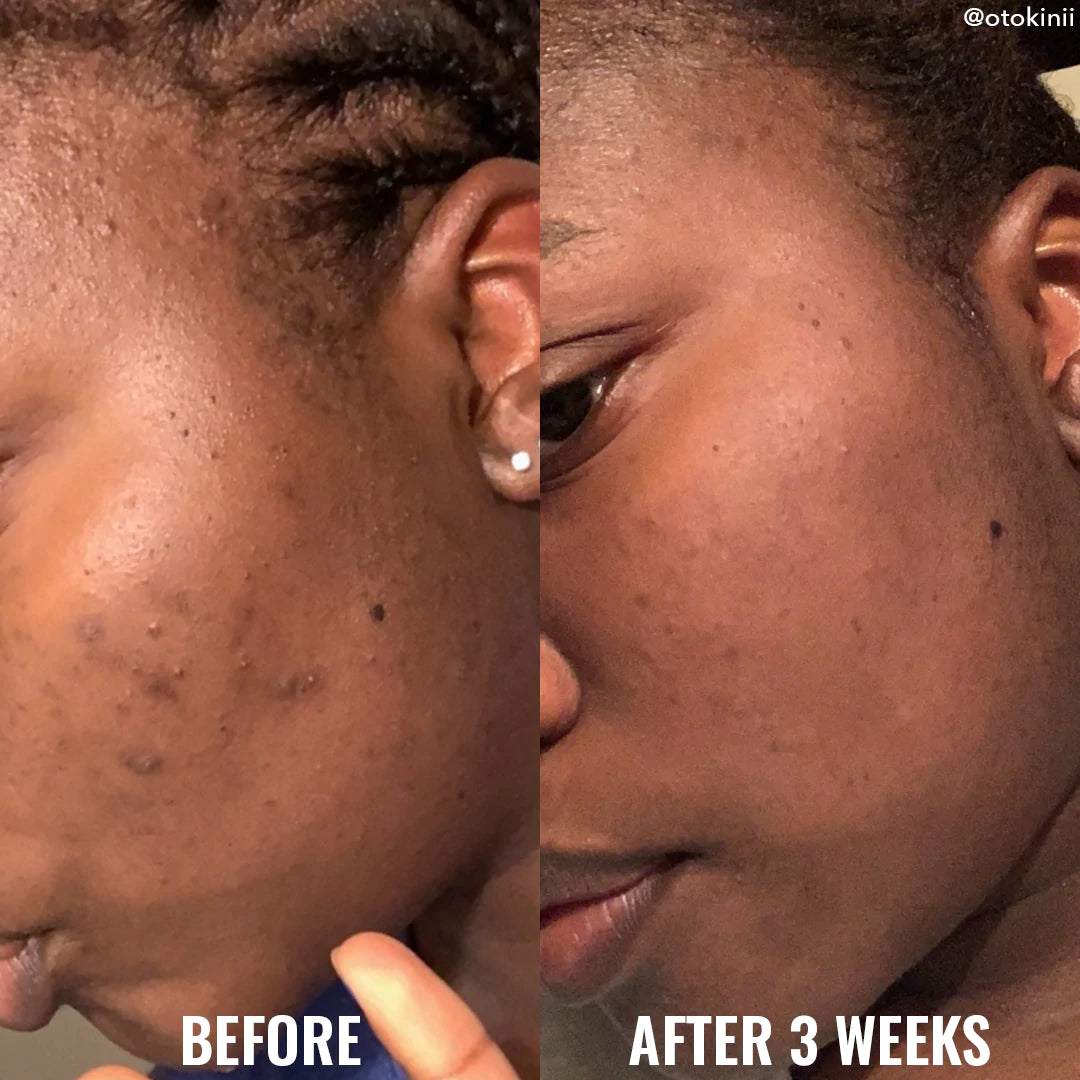 Good Molecules Discoloration Correcting Serum - Glamorous Beauty